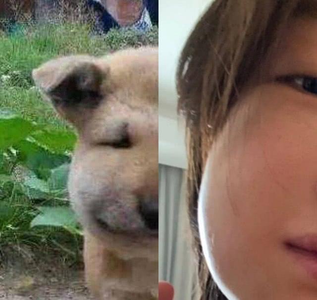 智齿冠周炎疼得厉害可以拔吗,智齿冠周炎上面牙也疼