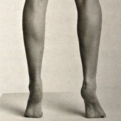 足踝损伤恢复方法,足踝损伤检查流程