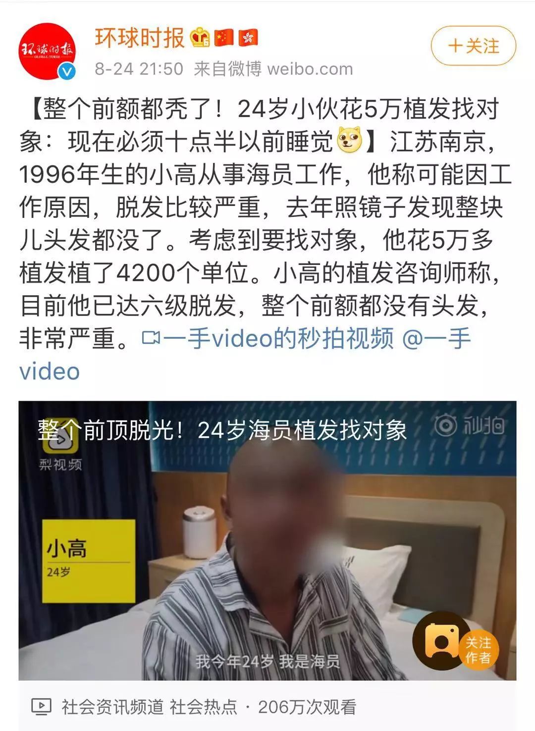 古代头发那么长会脱发吗,古人脱发了怎么办