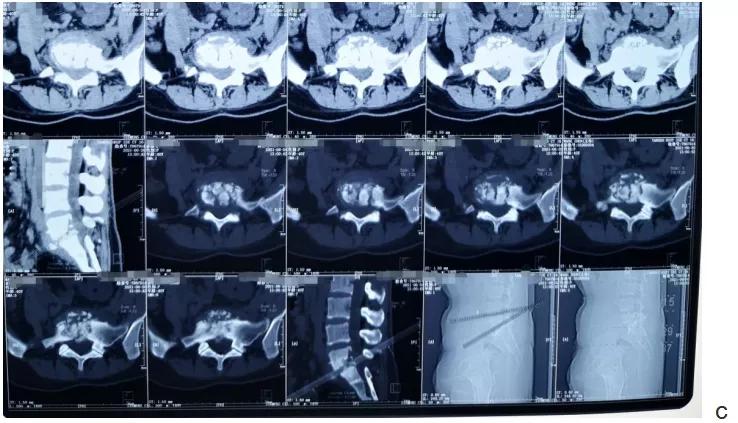 唐都医院脊柱科廖博,脊柱外科医生廖博