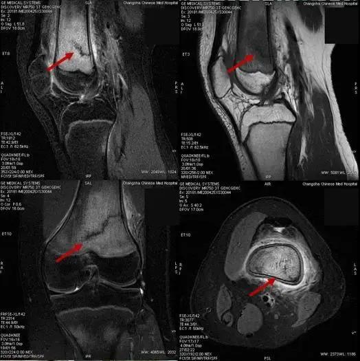 高度注意！三天诊断7例这类患者，都是返校学生！