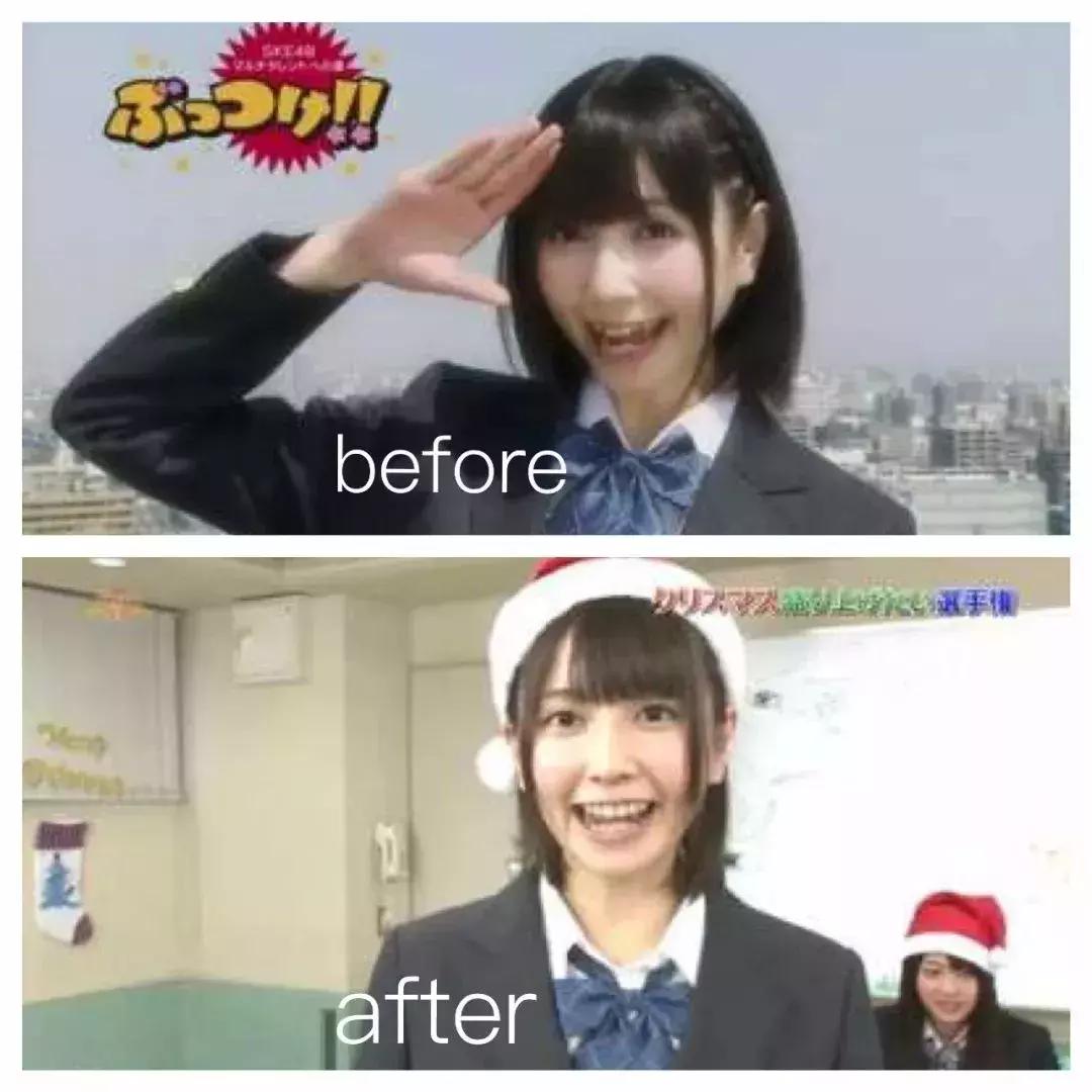 岛国人民竟然流行“八重齿”！*牙虎**真的可爱吗？