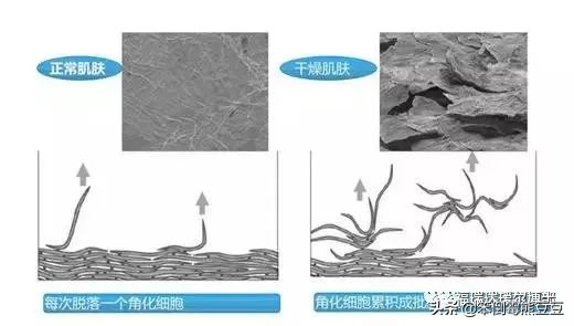 李佳琦推荐的福瑞达玻尿酸安瓶,福瑞达玻尿酸玻色因