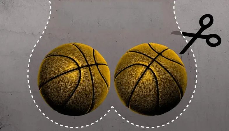 丈夫结扎妻子怀孕,太扎心男子2次结扎妻子怀孕