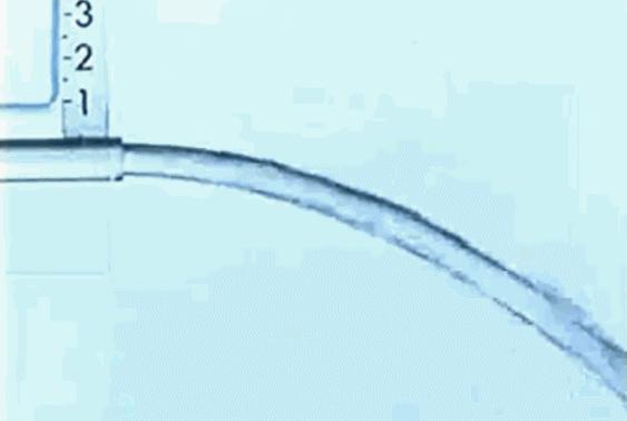 屁憋住不放以后去哪了,憋住不放的屁为啥还会来