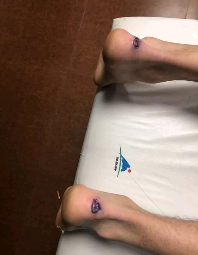 周琦伤情更新视频,周琦最新消息伤病恢复