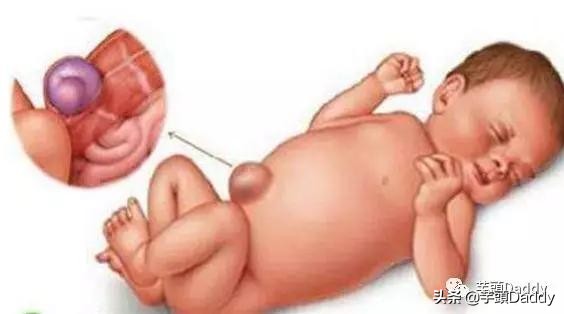 芋教QA：5周宝宝那些事儿