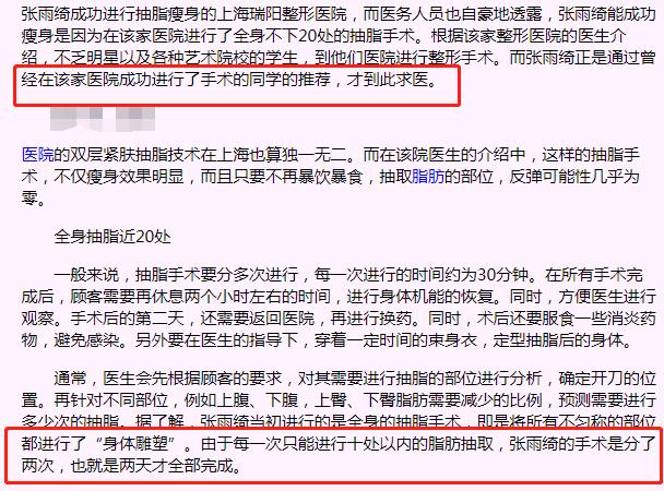 张雨绮腿抽脂,张雨绮抽脂瘦脸了么