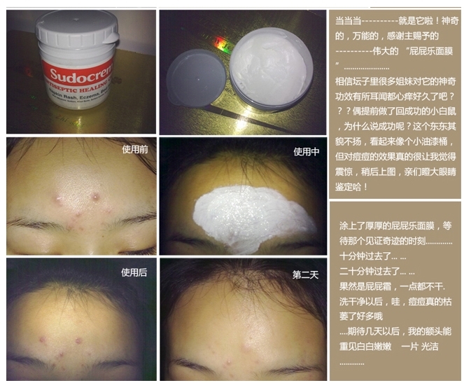 小仙女解决各种疑难杂症,小仙女一定要知道的美容小妙招