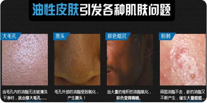 皮肤基础知识及各类皮肤护理重点,皮肤的基础医学知识及护理重点