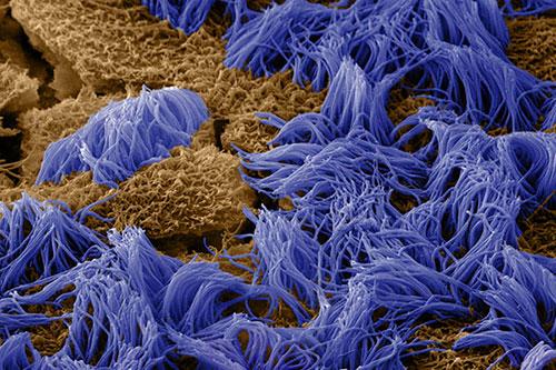 新冠肺炎对症用药指南,新冠肺炎的解读和总结