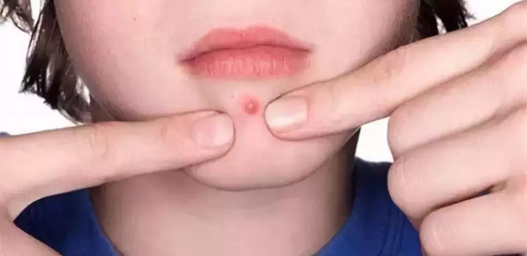 还不知道精油≠果油！你与美白错过了一个亿