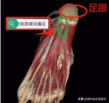 脚后跟走路疼但是没有肿起来,脚后跟走路不疼跑步疼