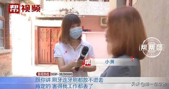 漂唇后嘴巴肿成什么样子,漂唇后嘴巴肿得像香肠