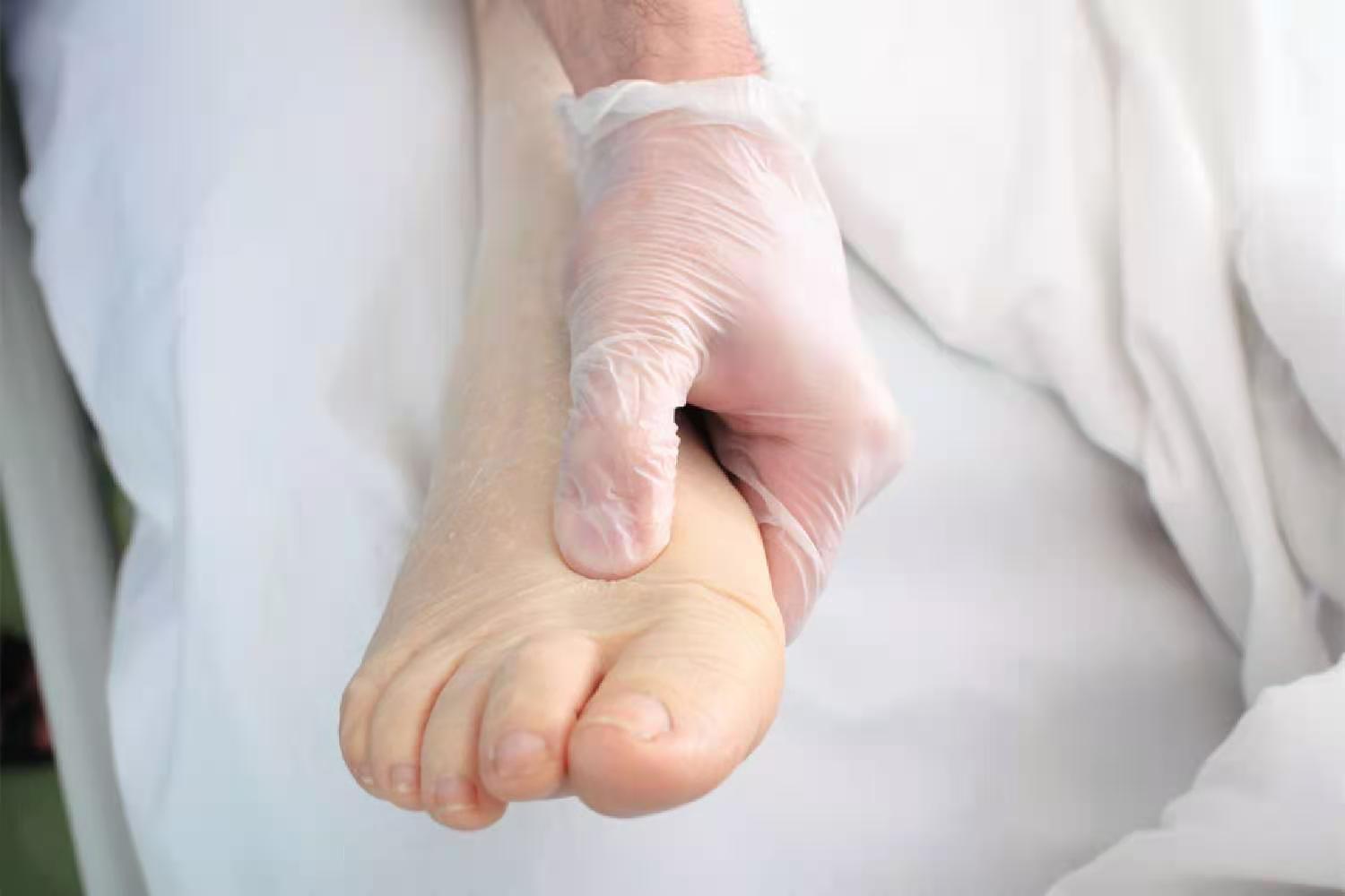 血管性水肿伴随荨麻疹能全麻吗,血管性水肿又称巨大荨麻疹