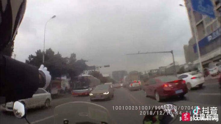 做包皮手术被割掉医院赔偿,割包皮手术后还要其他费用么