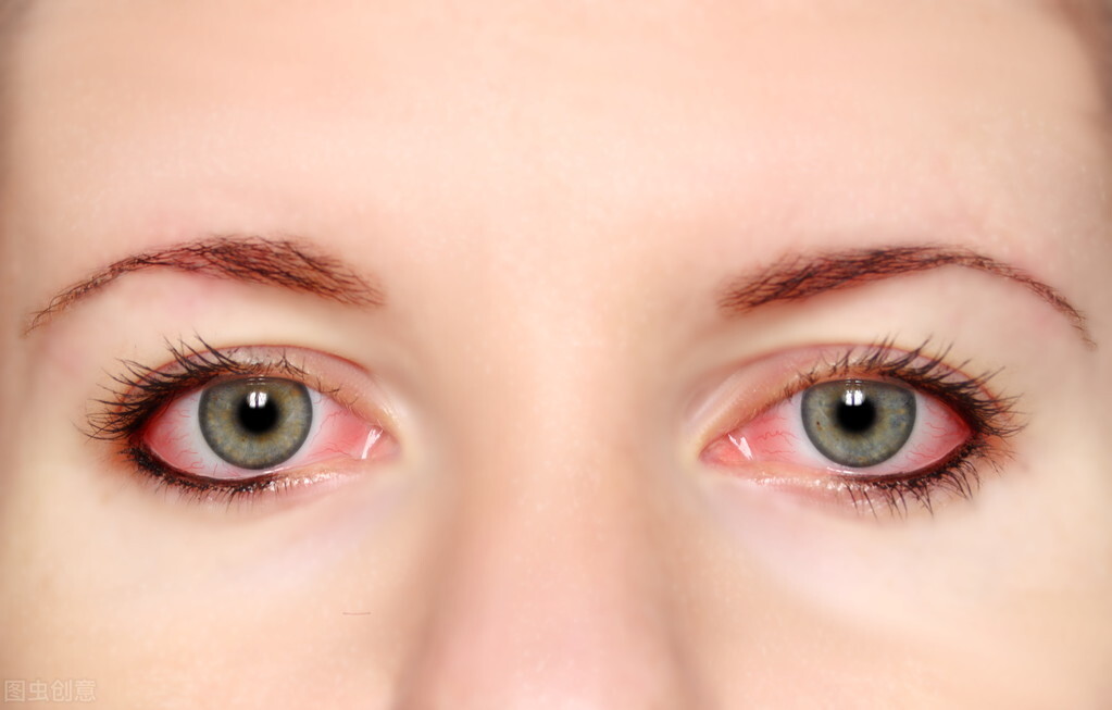 一招解决红眼病,鱼红眼病用什么药