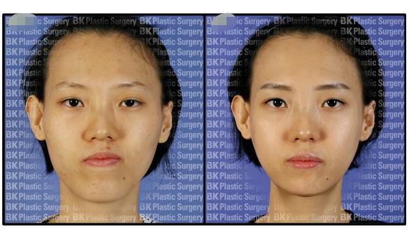 张开嘴巴“咔咔”响，牙断了？骨裂了？脱臼了？我会不会挂？