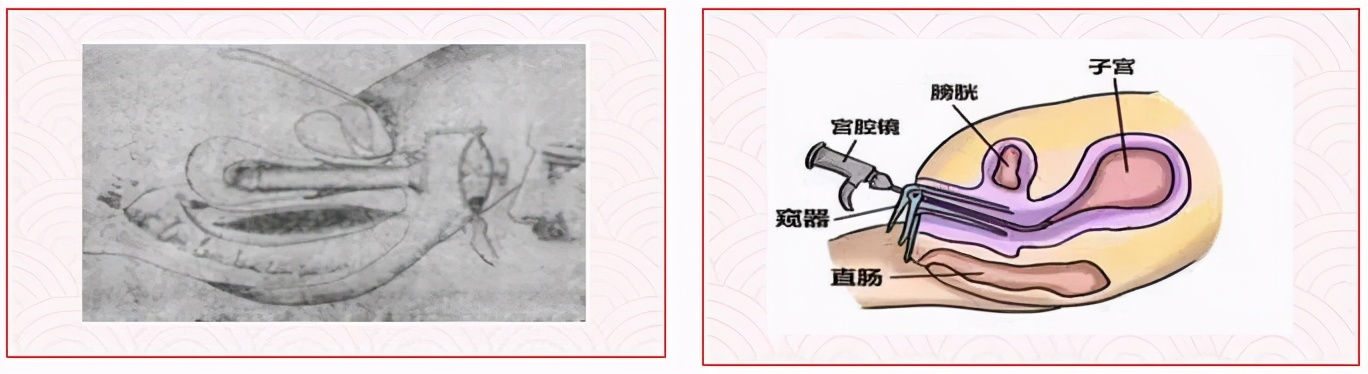 想看到子宫里面长的美不美吗？