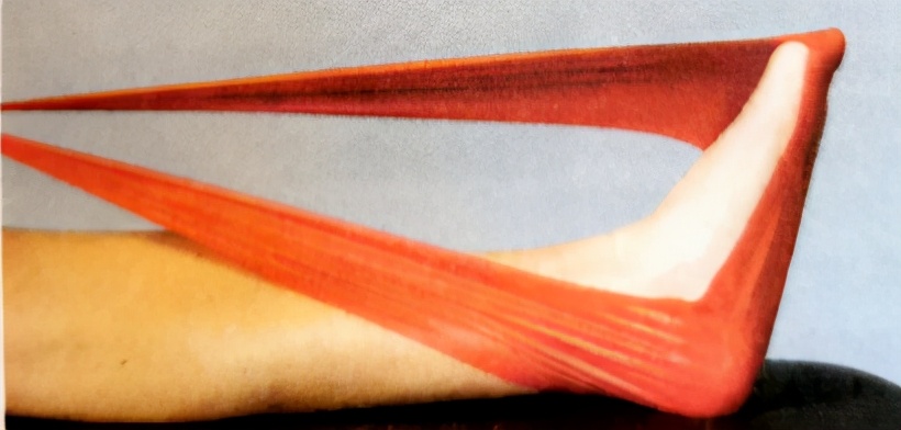 把o型腿变直手术过程,o型腿和xo型腿哪个更难矫正