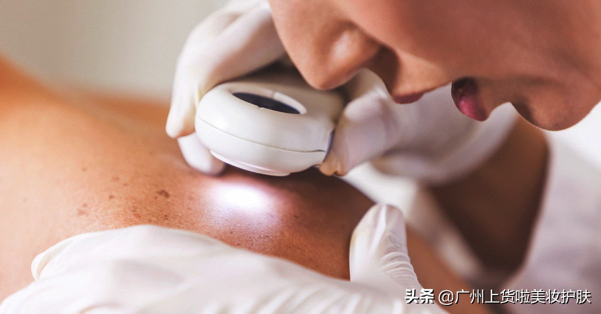 不要以为过敏只是小事,你以为的过敏实际的过敏