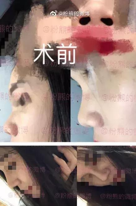 协和整形美容科专家,北京协和整形鼻综合
