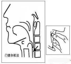 吞咽障碍有什么推拿手法,实用吞咽障碍手法训练技巧