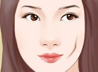 医美针剂注射方法,医美针剂注射项目有哪些