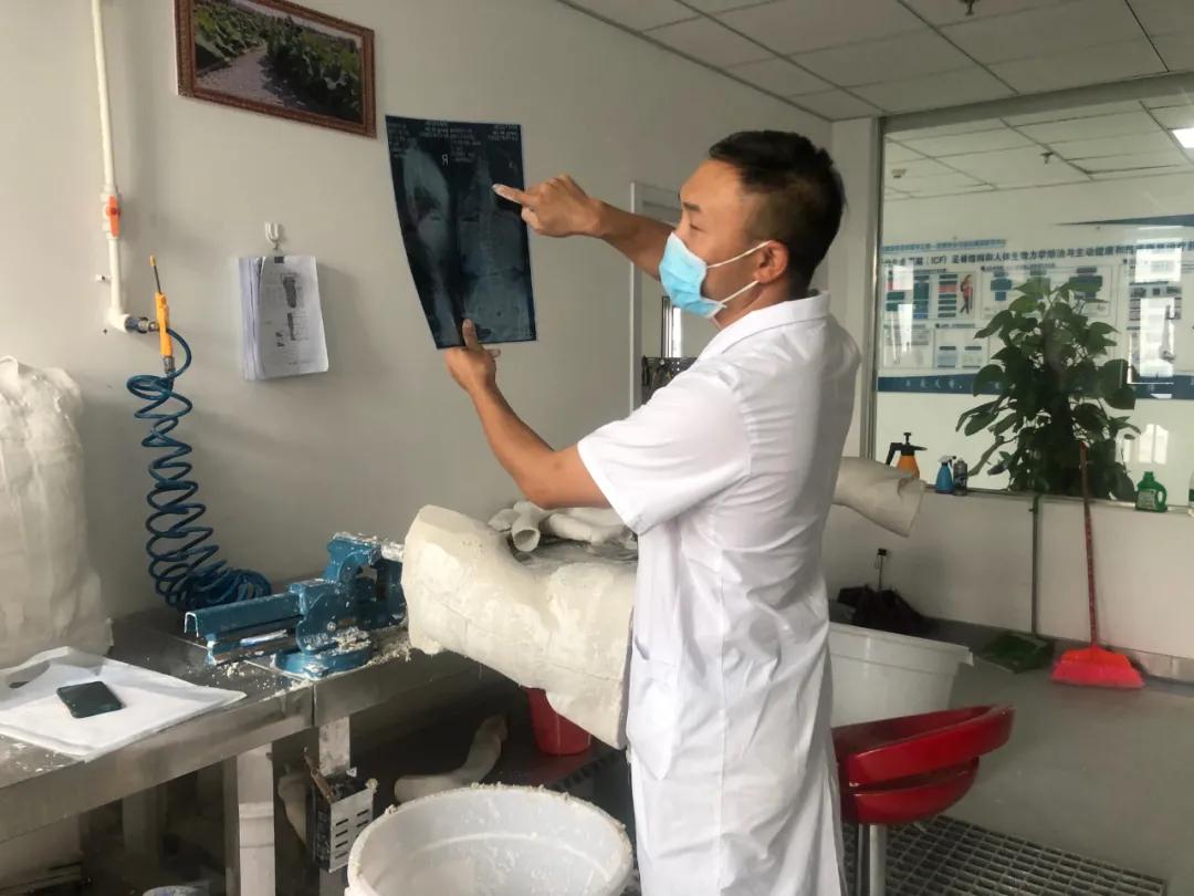 少儿圆肩驼背改善,驼背骨科矫正