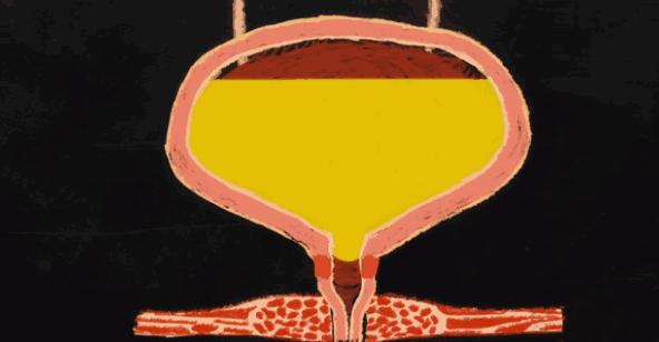 喝一点水就尿特别多是肾虚吗,一喝水就尿和不尿哪个身体更健康