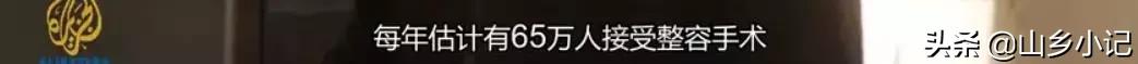 明明是整容脸现在却成了颜值巅峰,明明是整容脸却没被吐槽过