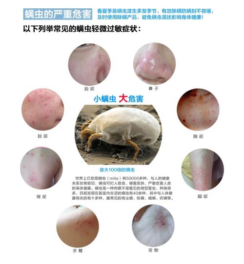 超棒国货去痘痘,祛除痘痘的国货测评