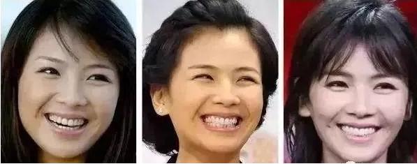 胡歌和刘涛谁的脸更好看,刘涛胡歌牙