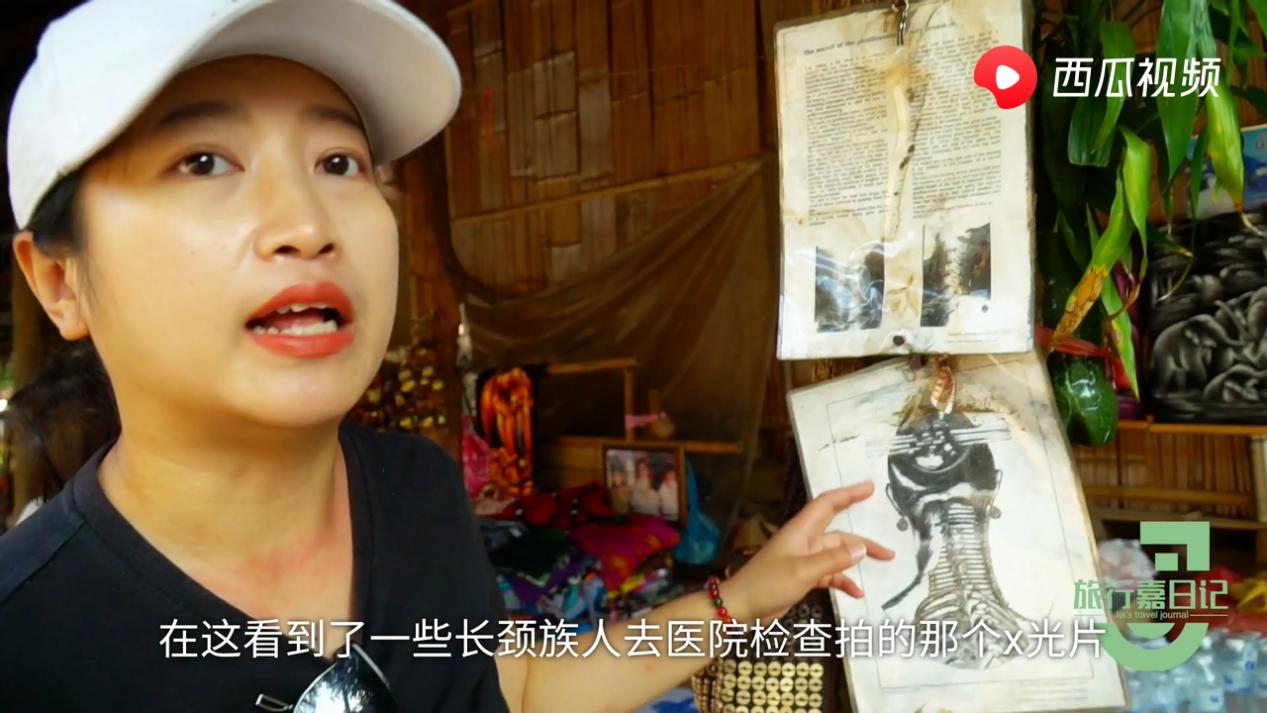 长颈族摘项圈视频,长颈族人的项圈