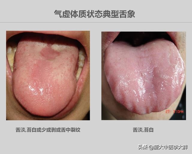 蹲几分钟起来头晕脚麻怎么回事,久蹲后脚麻头晕是什么原因