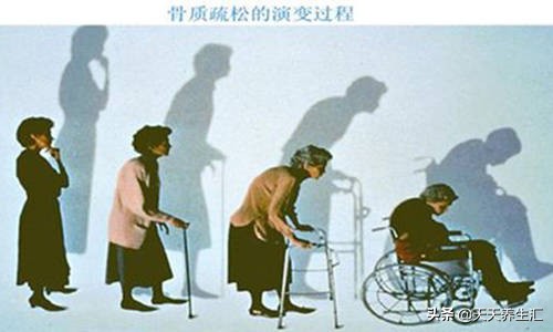 女性绝经后身体可能会有3个变化,女性绝经后出现这些症状