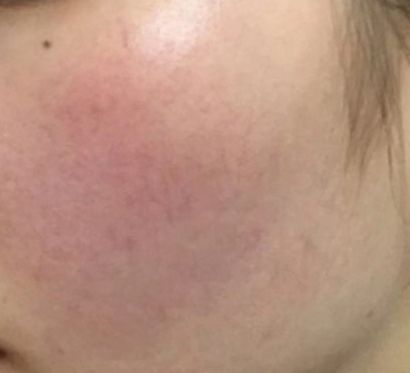 敏感肌适合的洗面奶乳液,适合红血丝皮肤的乳液