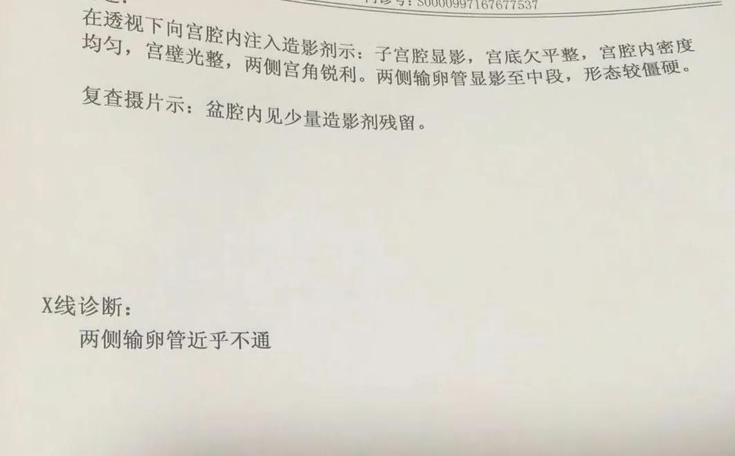 当取卵针戳进我的卵巢时，丈夫在看片取精|成为母亲