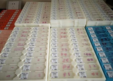 涨知识的问答视频,常用组织切片方法