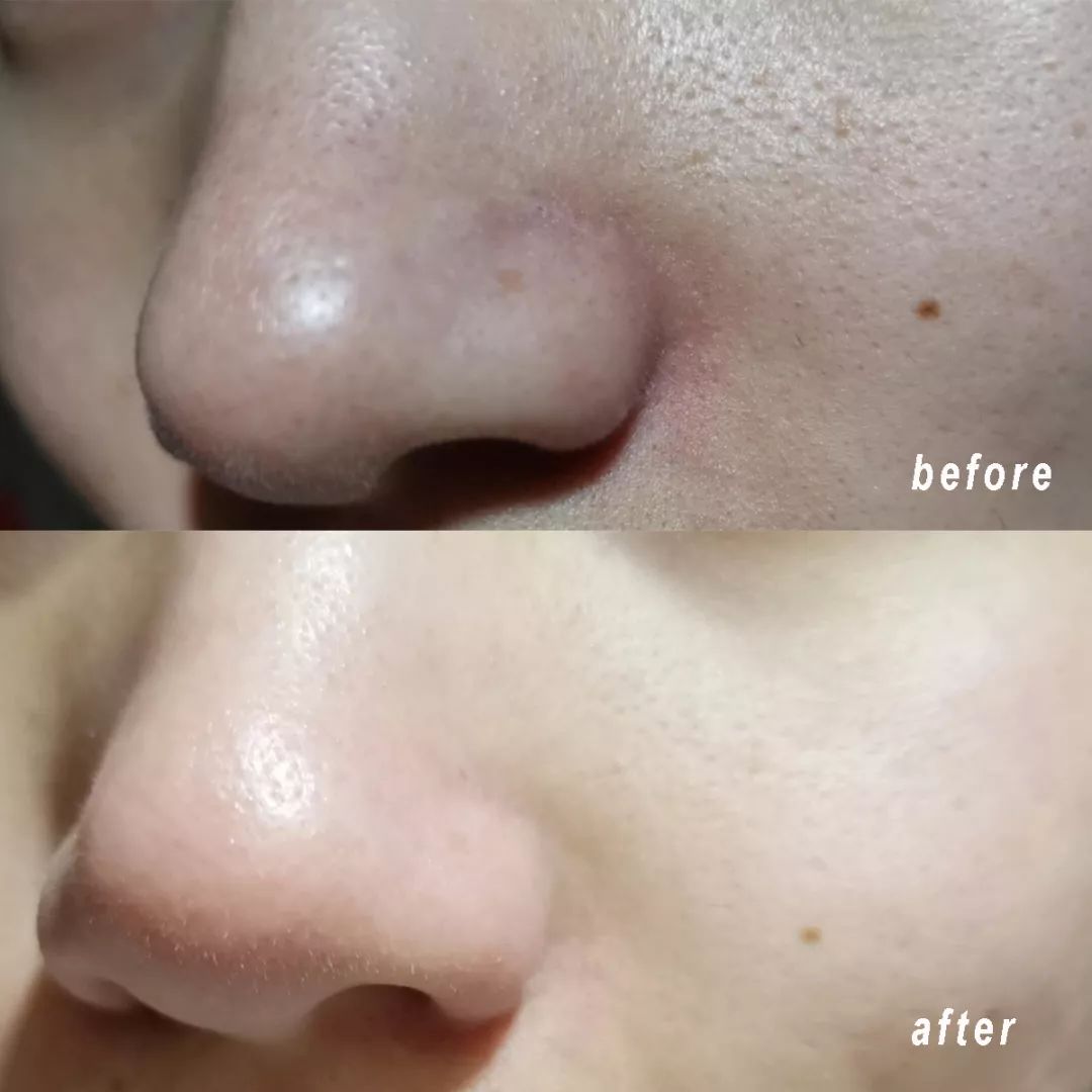 清洁面膜测评,清洁面膜测评打假