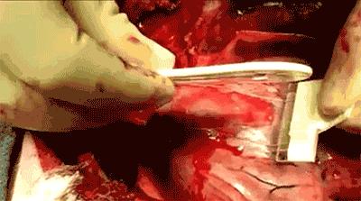 人体中自带的黑科技,超级实用的各种黑科技