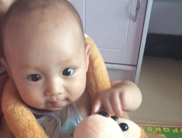 婴儿头发浓密和稀少的原因,宝宝出生头发浓密后面变稀少