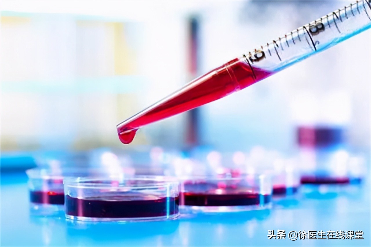 血友病能治好吗有可能吗,血友病能不能彻底治好