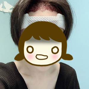 发际线太高怎么办,发际线太高怎么办做什么发型