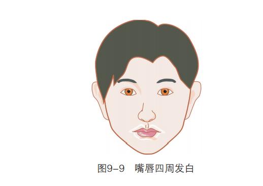 唇色异常有哪几种表现,唇色发白预示什么病症