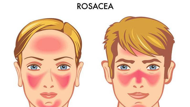注意饮食护肤,注意饮食健康最重要