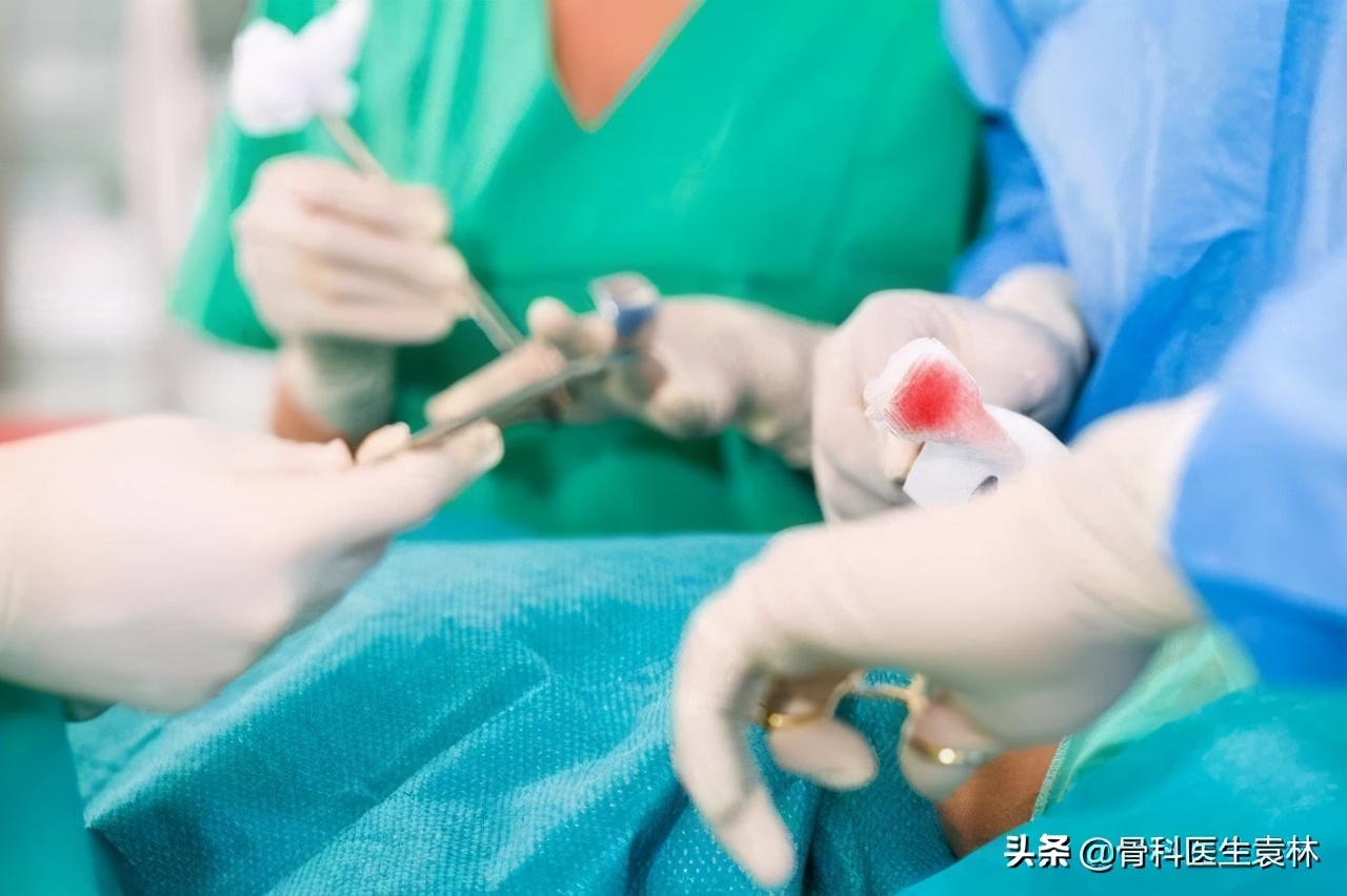 膝盖在上下楼时疼是怎么回事,膝盖疼痛休息减轻活动加重