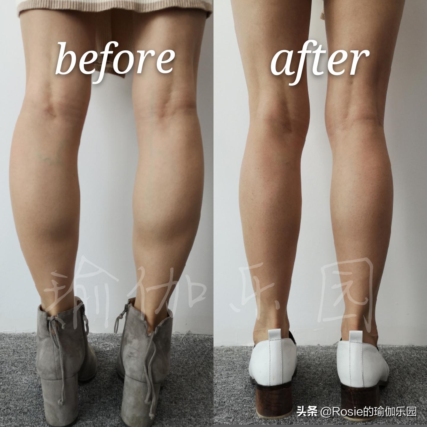 如何告别粗壮小腿,如何消除小腿赘肉