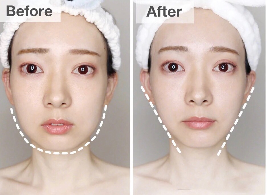 瘦脸操圆脸,改善脸型瘦脸操