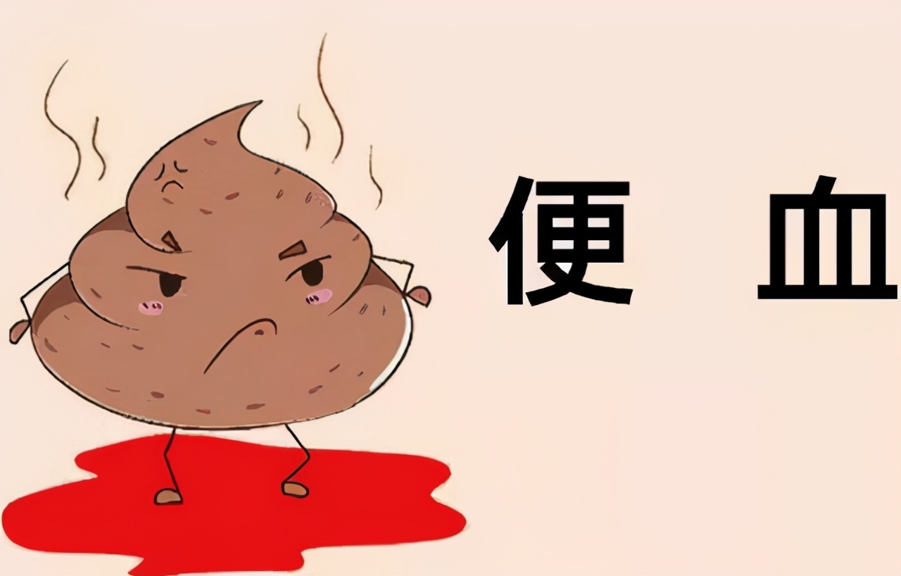 直肠癌早期5大症状有哪些,直肠癌大便带血是早期还是晚期